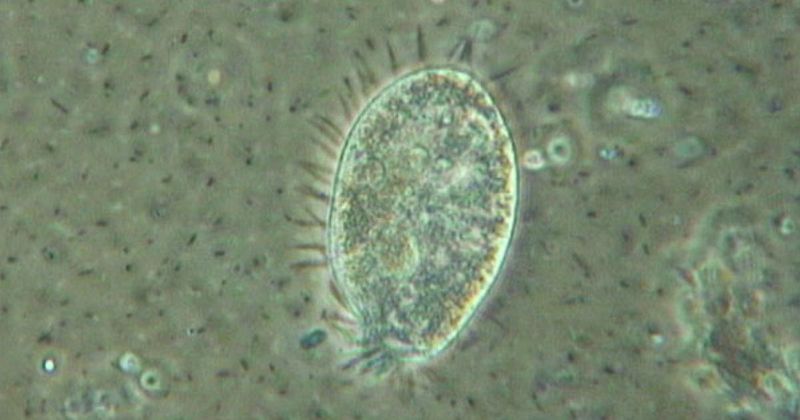 Protozoa