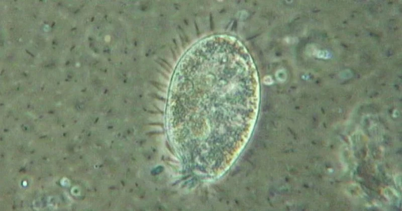 Protozoa