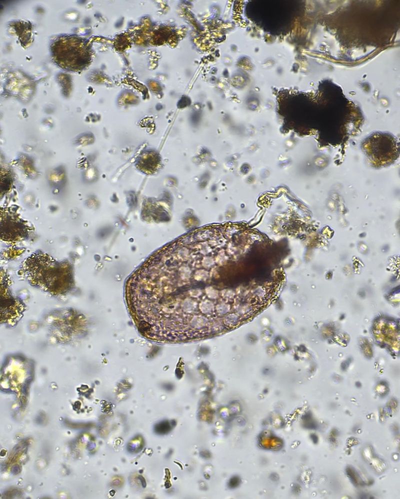 Protozoa