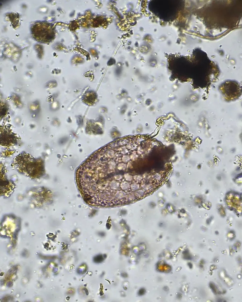 Protozoa