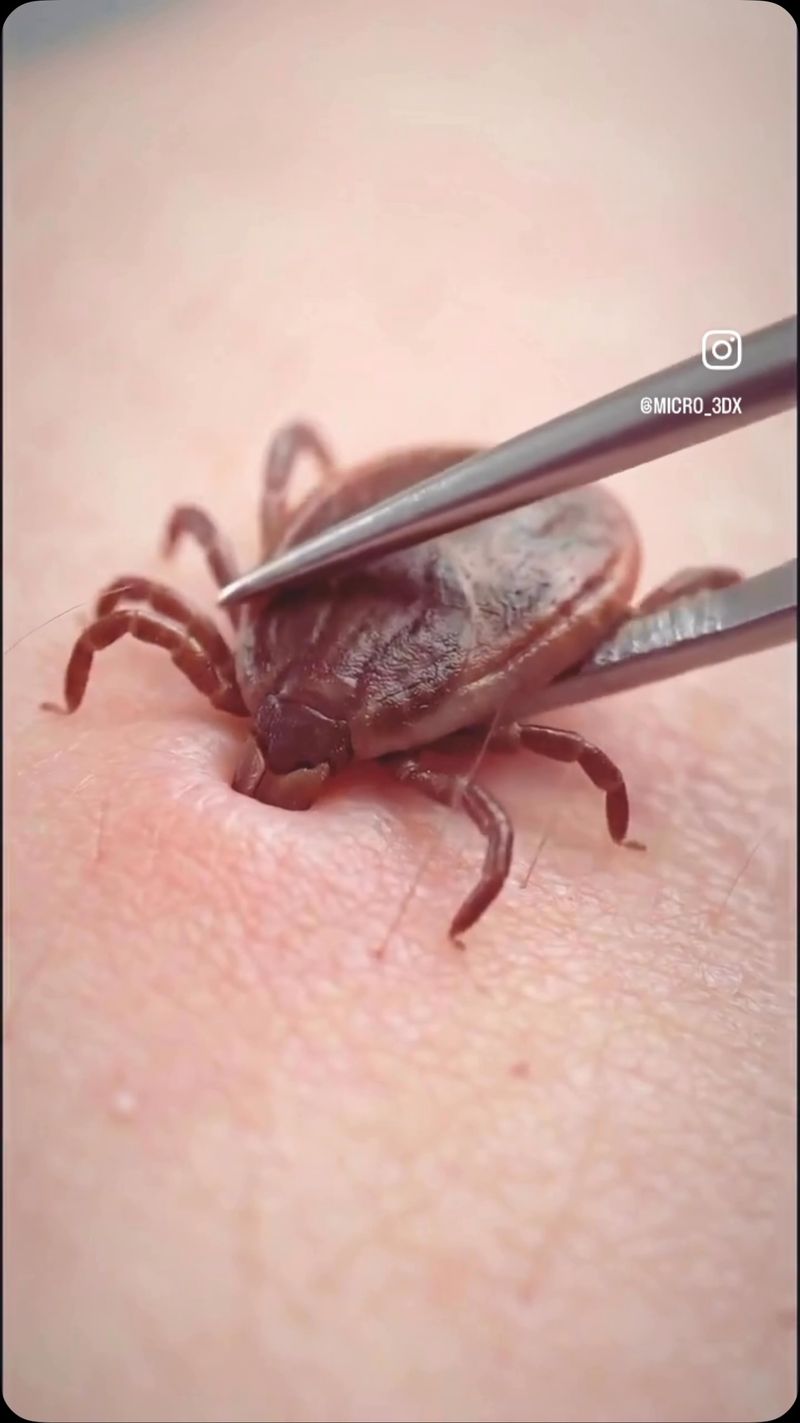 Remove An Attached Tick Promptly