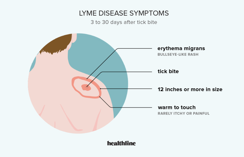 Monitor Symptoms And Ask About Lyme Prevention