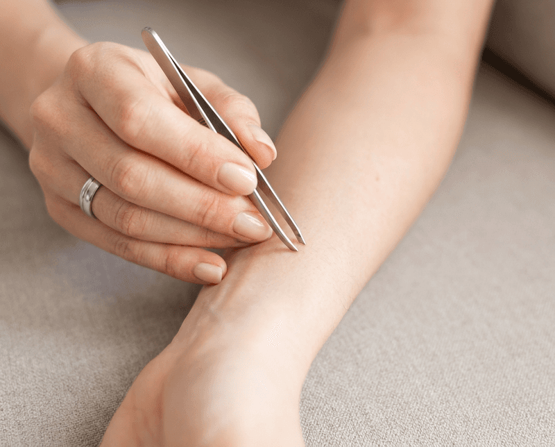 Remove The Tick With Fine-Tipped Tweezers